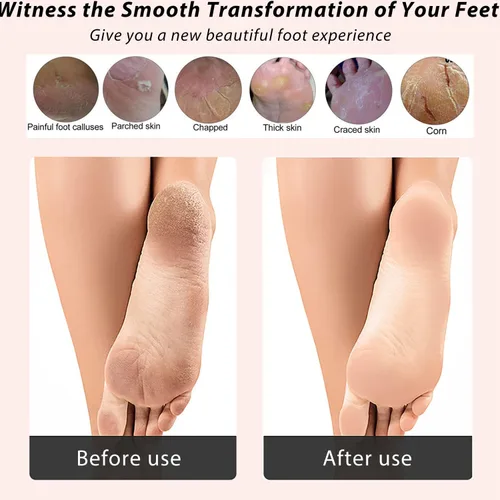 Vista 5 de ICDI ICANdOIT - Lima de bambú natural para pies, removedor de callos multiusos 4 en 1 pies, kit de pedicura con cepillo de cerdas de jabalí, piedra