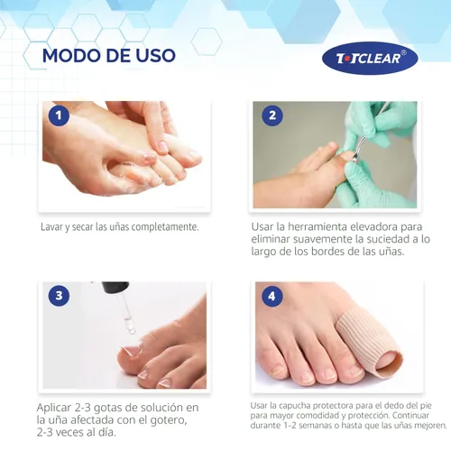 Vista 5 de Alivio de Uñas Encarnadas: Herramienta para Uñas Encarnadas para Hombres Mujeres - Kit de Eliminación de Uñas Encarnadas - Gotas Correctoras de Uñas