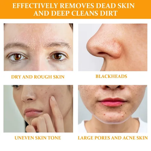 Vista 2 de Gel exfoliante naranja para cara y cuerpo, gel de pelado naranja, piel hidratante profunda y suciedad de poros de limpieza (2 unidades)