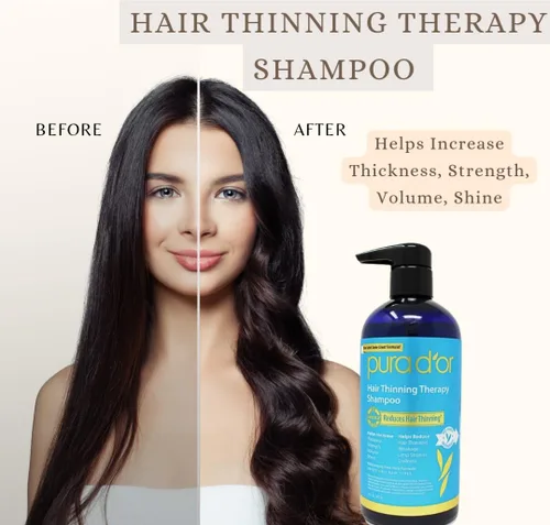 Vista 4 de Pura D'or Champú terapéutico para adelgazamiento del cabello, 16 onzas, paquete de 2