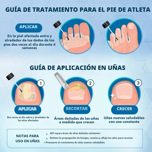 Vista 4 de Ebanel Paquete de tratamiento de hongos de 1 oz y 2 paquetes de crema de urea al 40% de 4.6 onzas
