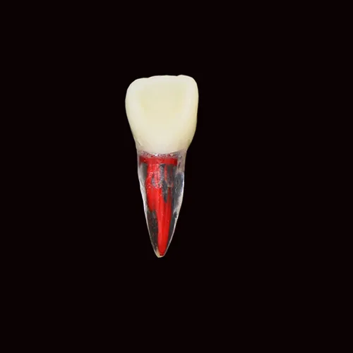Vista 3 de 8pcs dientes modelo endodoncia endodoncia archivo RCT práctica pulpa para enseñanza estudio