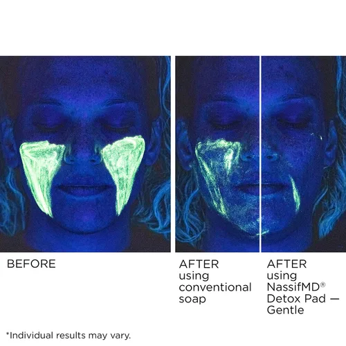 Vista 5 de NassifMD Almohadillas de desintoxicación suaves, complejo de ácido frutal creado por cirujanos para pieles sensibles, ilumina, exfolia y reduce