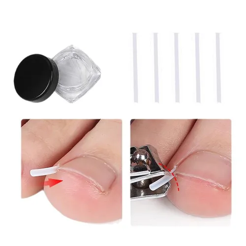 Vista 6 de Juego profesional de uñas encarnadas con tiras transpirables de uñas encarnadas, tiras correctoras de uñas de los pies, parche corrector de uñas