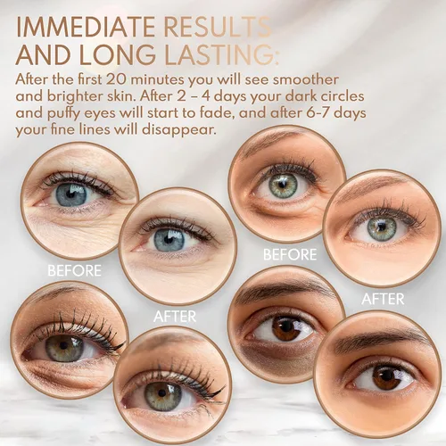 Vista 4 de Máscara antienvejecimiento para ojos para debajo de los ojos, tratamiento de parche de colágeno para minimizar arrugas, ojos hinchados, bolsas
