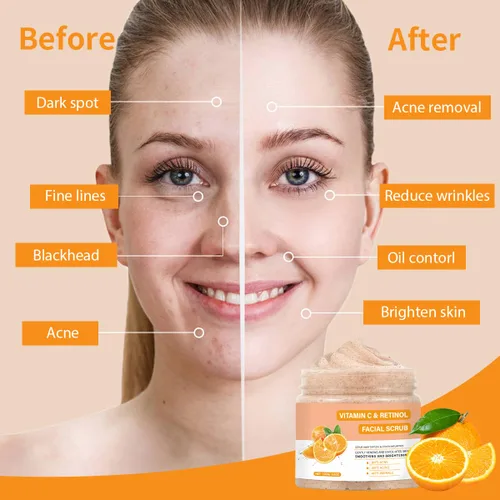 Vista 2 de Exfoliante Facial con Vitamina C, Jabón Exfoliante Facial con Retinol, Jabón Exfoliante Facial, Exfoliante Facial para Mujeres, Jabón Limpiador