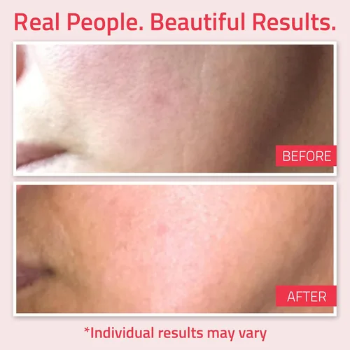Vista 4 de YEOUTH Crema de retinol para cara, hidratante facial de retinol para mujeres y hombres con ácido hialurónico y té verde, hidratante nocturno