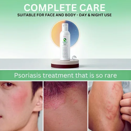 Vista 6 de SORARESAL Crema para la psoriasis – Remedio de confort con aceite de cártamo, aceite de coco y ácido salicílico para la picazón, la piel escamosa