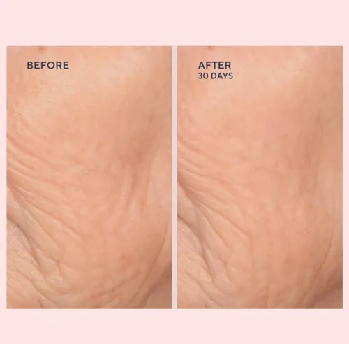 Vista 3 de Serious Skincare C-EXTREME RESULTS 2 oz - Exfoliante facial de limpieza profunda y rejuvenecimiento de poros, vitamina C, colágeno y enzimas