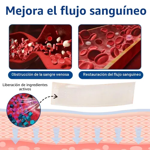 Vista 4 de Vein Target Microdarts Patch, tratamiento profesional de venas varicosas para piernas, parche GFOUK Vein Target, alivia la circulación sanguínea