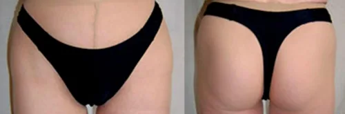Vista 2 de SILKIES Gaff - Tanga - Tucking - Crossdressing - Transgénero