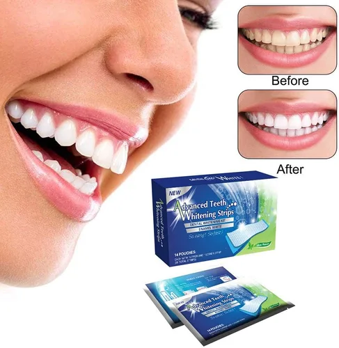 Vista 2 de Arinda Tiras de blanqueamiento de dientes de gel para blanquear los dientes, kit de higiene bucal para carillas de dientes