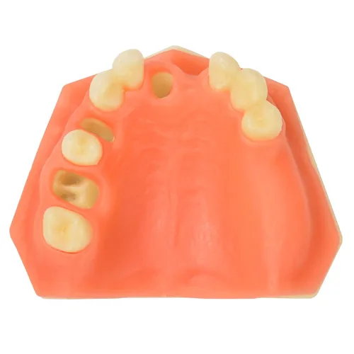 Vista 10 de Ultrassist Entrenamiento de implantes dentales Modelo edéntulo maxilar, maxilar simplificado con tejido suave, gran diente de entrenamiento