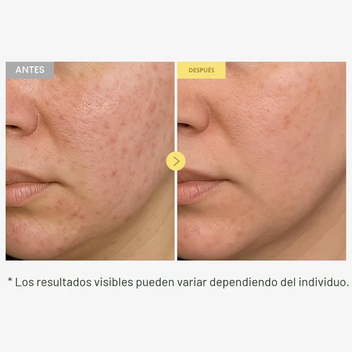 Vista 3 de TOSOWOONG Honey Glow 65% Propolis Serum, Ácido Hialurónico, Ácido Kójico, Niacinamida, Hidratante Facial Calmante para Tono de Piel Irritado