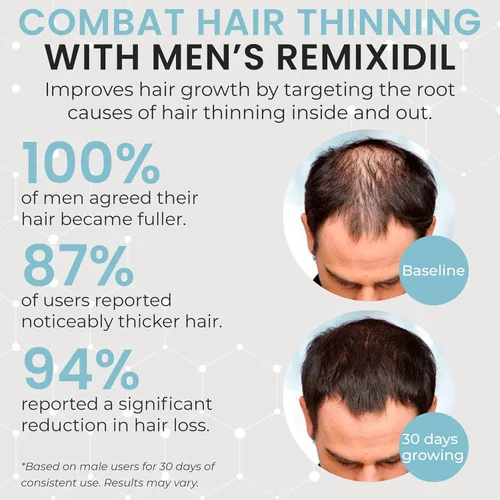 Vista 3 de Vitaminas para el crecimiento del cabello para hombres Apoya la fuerza de la barba y el cuero cabelludo Ayuda a reducir el adelgazamiento