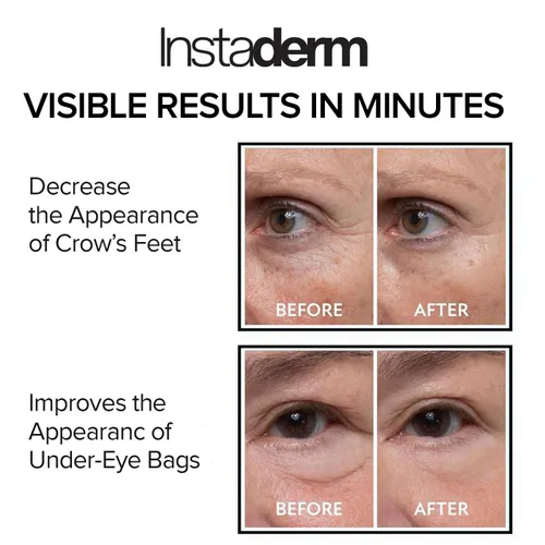 Vista 4 de Apretador instantáneo de ojos: elimina las bolsas debajo de los ojos y la hinchazón. Elimina las ojeras y las arrugas. Crema hidratante naturalmente