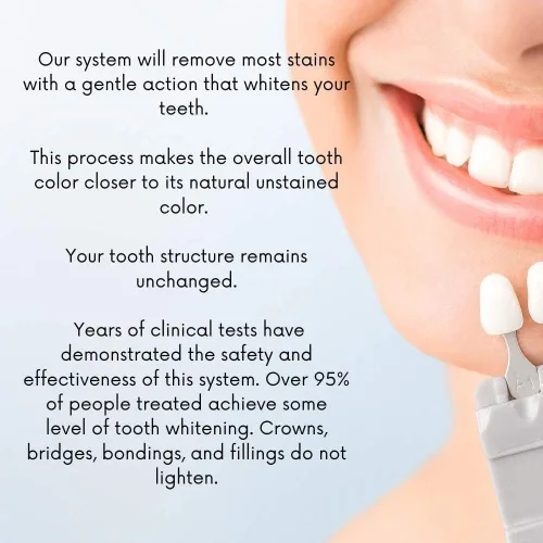 Vista 4 de Gel blanqueador dental 44% peróxido de carbamida, 6 jeringas de gel blanqueador de dientes