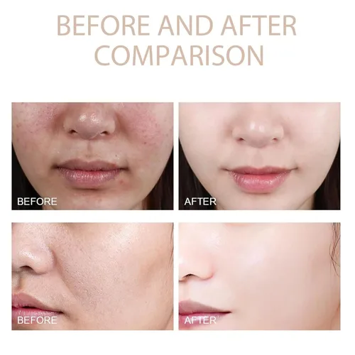 Vista 4 de Gel exfoliante purificador de 2 piezas, gel hidratante exfoliante purificador, adecuado para uso facial y corporal