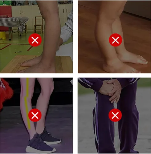 Vista 6 de Soporte inmovilizador fijo de rodilla, ortesis de hiperextensión de rodilla, se usa en 10 segundos, diseño antirotación, ligero y cómodo