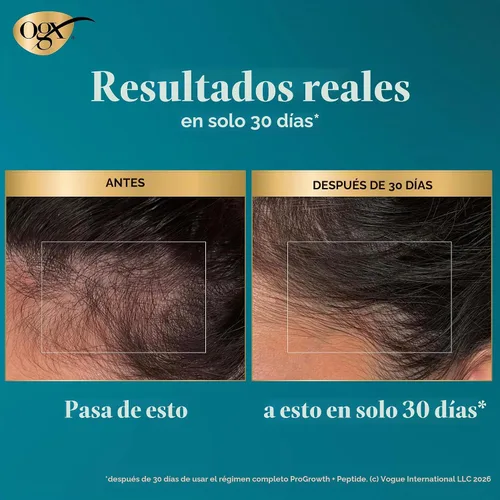 Vista 7 de OGX ProGrowth + Peptide Scalp Serum, 0.33 fl. oz