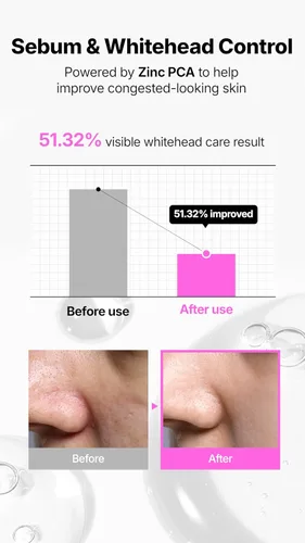 Vista 4 de starlike Suero de poros al 21% de niacinamida I 1.69 fl oz (1.7 fl oz) I Suero facial hidratante y equilibrante de aceite I Suero facial calmante