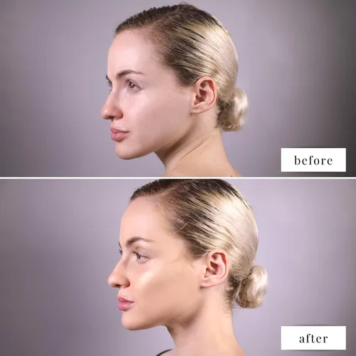 Vista 7 de Elizabeth Mott Show Me Your Glow - Iluminador en polvo 2 en 1 y sombra de ojos brillante, maquillaje natural con brillo facial, libre de crueldad