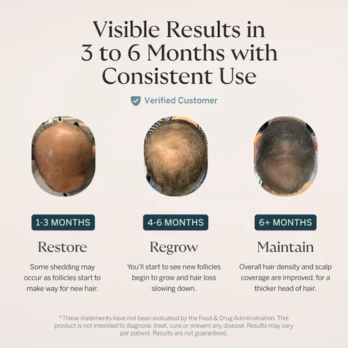 Vista 3 de Suplemento Happy Head para el crecimiento del cabello para hombres y mujeres – Cabello más grueso y abundante con Saw Palmetto, Ashwagandha