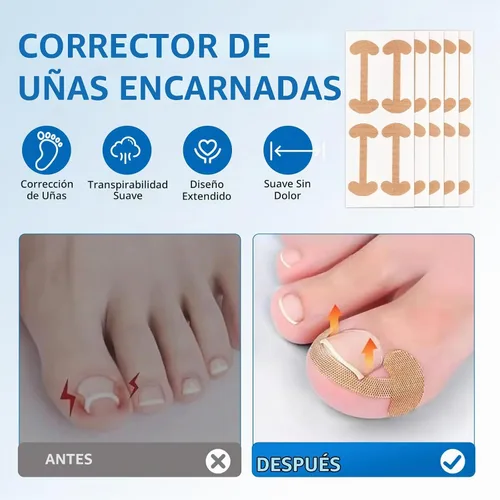Vista 3 de Kit de eliminación de uñas encarnadas, 50 tiras correctoras de uñas encarnadas sin dolor con levantador de uñas de los pies, lima sin dolor, kit