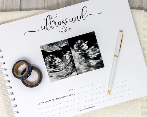 Vista 22 de Personalized Twin Pregnancy Journal (8 Center Designs) - Hardcover Pregnancy Memory Book Customized with Babies’ Names, Nicknames or Phrase
