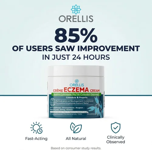 Vista 5 de Crema para eccema con avena coloidal orgánica, caléndula y propóleos, ungüento natural para aliviar el eccema facial y cuerpo. Alivio instantáneo