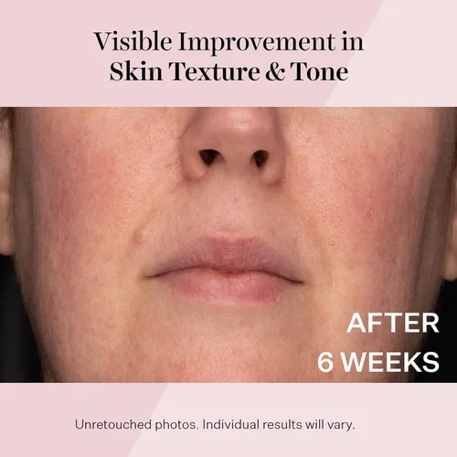 Vista 7 de StriVectin Advanced Retinol, Targets Visible Signs of Aging for Healthier Skin