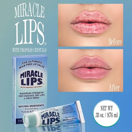 Vista 3 de Holocuren Miracle Lips Salve, 0.33 onzas