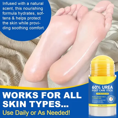 Vista 8 de Crema en barra de urea 60% más 2% ácido salicílico, crema de urea para pies y callos de máxima fuerza para talones secos agrietados, manos