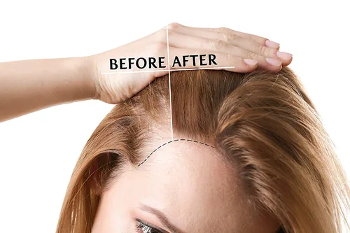 Vista 7 de OPO Aceite de semilla de camelia, 8 onzas, puro, sin refinar, prensado en frío, sin OMG, aceite portador japonés a granel para piel, cabello, uñas