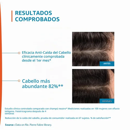 Vista 5 de Ducray Creastim Reactiv Loción para la pérdida del cabello 2.0 fl oz