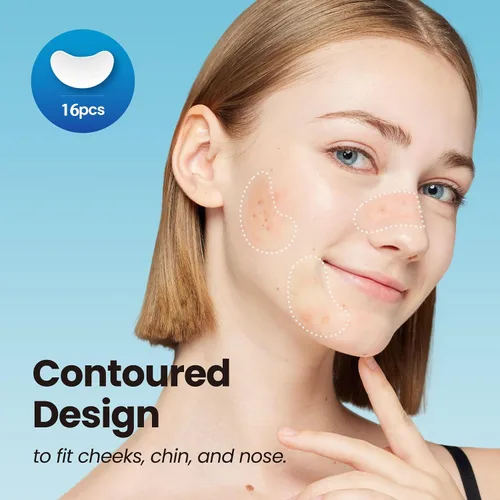 Vista 5 de DERMA ANGEL Parches grandes para espinillas para nariz, mentón y frente, poros de brotes y tratamiento de manchas, parches para acné hidrocoloide