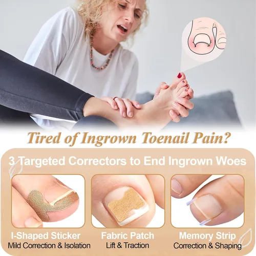 Vista 2 de Kit de eliminación y corrector de uñas encarnadas para un alivio rápido del dolor, kit profesional de tratamiento de uñas encarnadas con tiras