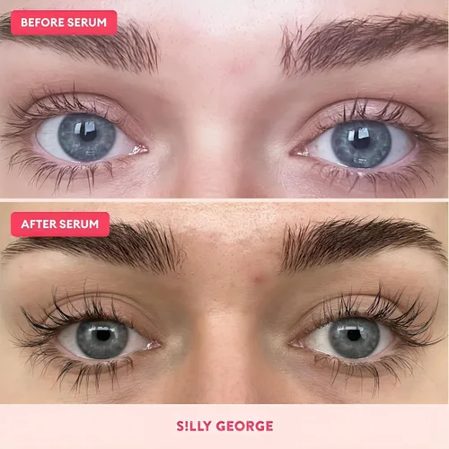 Vista 6 de Silly George Suero de crecimiento de pestañas para cejas más gruesas, más llenas, más largas y atrevidas, suero premium, potenciador de pestañas