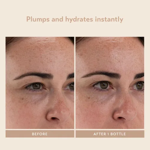 Vista 6 de SHANI DARDEN SKIN CARE - Suero hidratante e hidratante para la cara, suero facial hidratante con hongos de nieve y glicerina para una hidratación