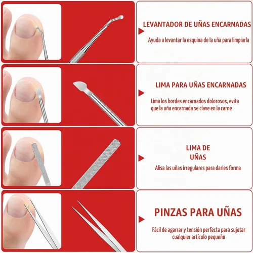 Vista 6 de Kit de eliminación de uñas encarnadas, kit de herramientas de uñas encarnadas con corrector de uñas encarnadas, gotas de uñas encarnadas, parche