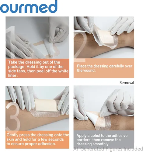 Vista 7 de Ourmed Soft Flex Apósitos de espuma de silicona (4 pulgadas x 4 pulgadas, paquete de 10) estériles, altamente absorbentes, impermeables, borde