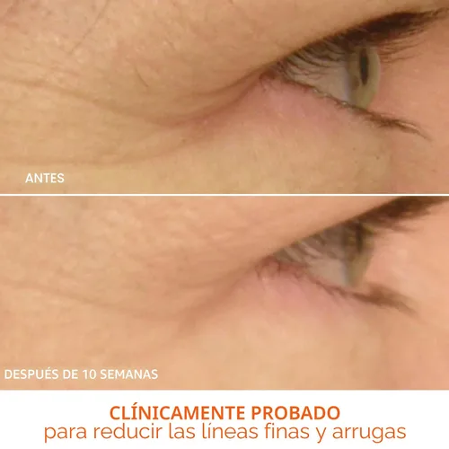 Vista 6 de Dr Dennis Gross DRx SpectraLite Eyecare Max Pro