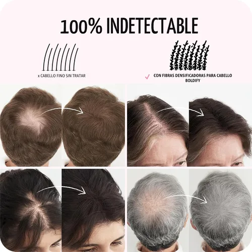 Vista 5 de BOLDIFY Fibras capilares para cabello fino, para mujeres y hombres, marrón Marrón cenizo