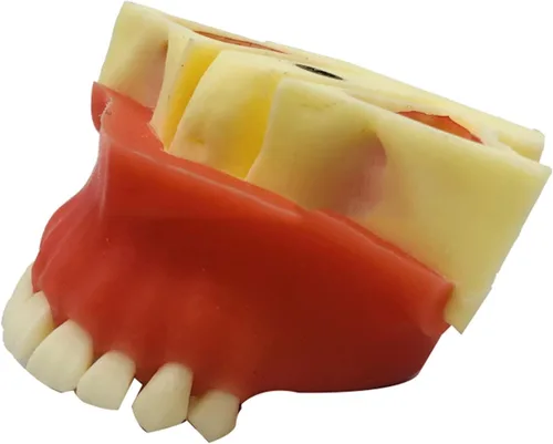 Vista 3 de Modelo de dientes de implante dental - Modelo de elevación del seno maxilar - Modelo de práctica de implante oral para educación, comunicación