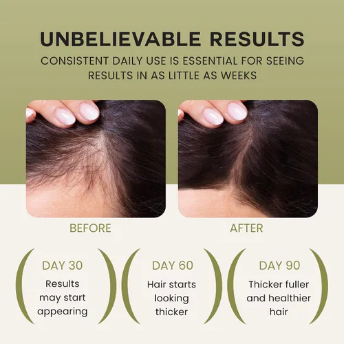 Vista 3 de Lebanta Aceite de Batana para el crecimiento del cabello, mezcla 100% pura, cruda y natural con ricino orgánico, semillas de calabaza, coco y aceite