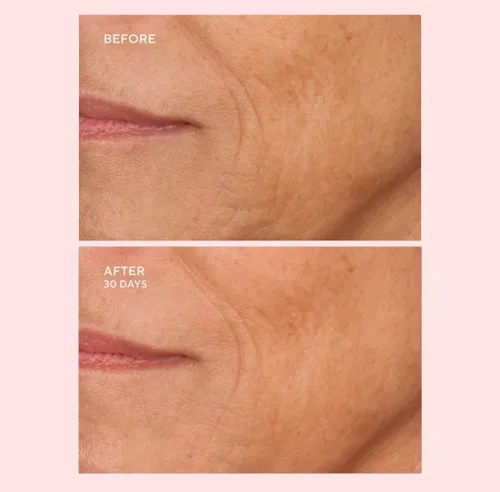 Vista 6 de Serious Skincare C-EXTREME RESULTS 2 oz - Exfoliante facial de limpieza profunda y rejuvenecimiento de poros, vitamina C, colágeno y enzimas
