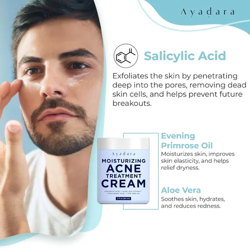 Vista 2 de Crema hidratante para el acné, hidratante facial de ácido salicílico para pieles grasas y propensas al acné, ayuda con espinillas, puntos negros