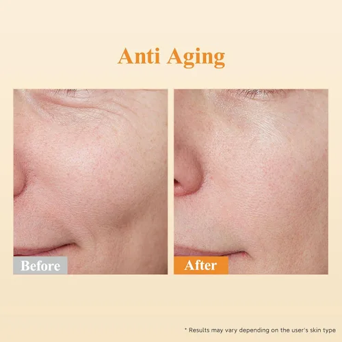 Vista 8 de Triple Retinol Serum para la cara – Anti-envejecimiento arrugas noche retinol +HPR cápsulas, suero peptídico para mujeres, reduce líneas finas