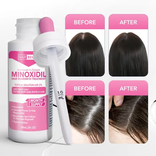 Vista 4 de Liquid Minoxidil Mujeres 2% por ciento – Solución tópica