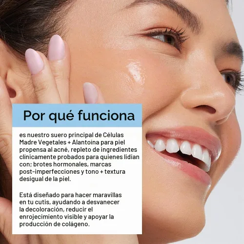 Vista 5 de CLEARstem CELLRENEW - Suero facial con células madre y ácido hialurónico, 1 onza